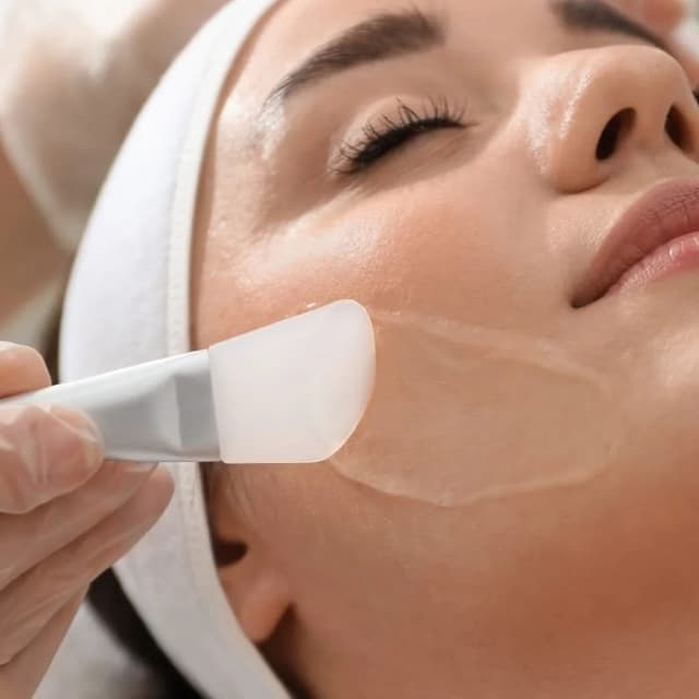 Chemical peels