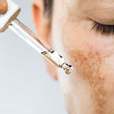 Pigmentation & melasma